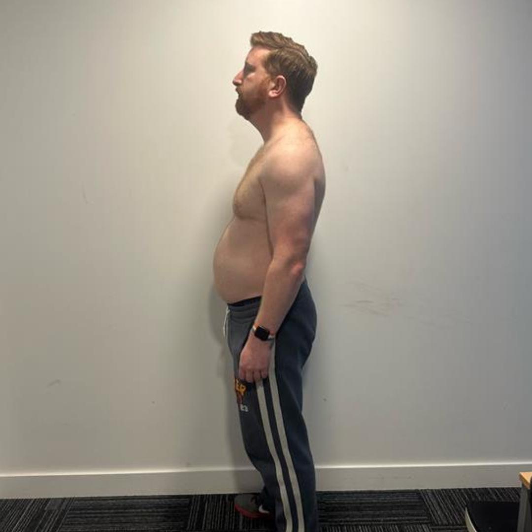 Before photo of Alex