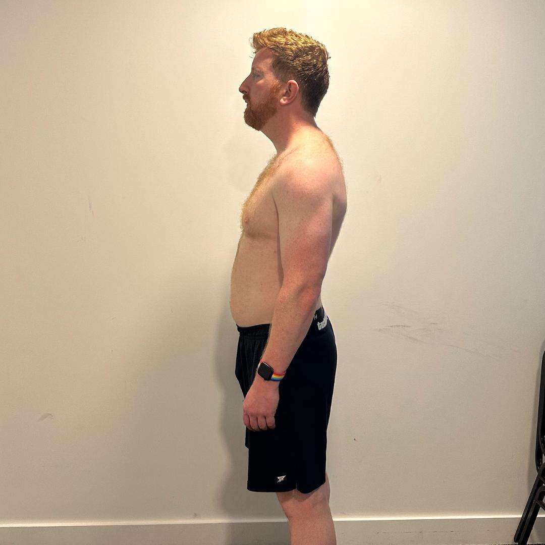 After photo of Alex