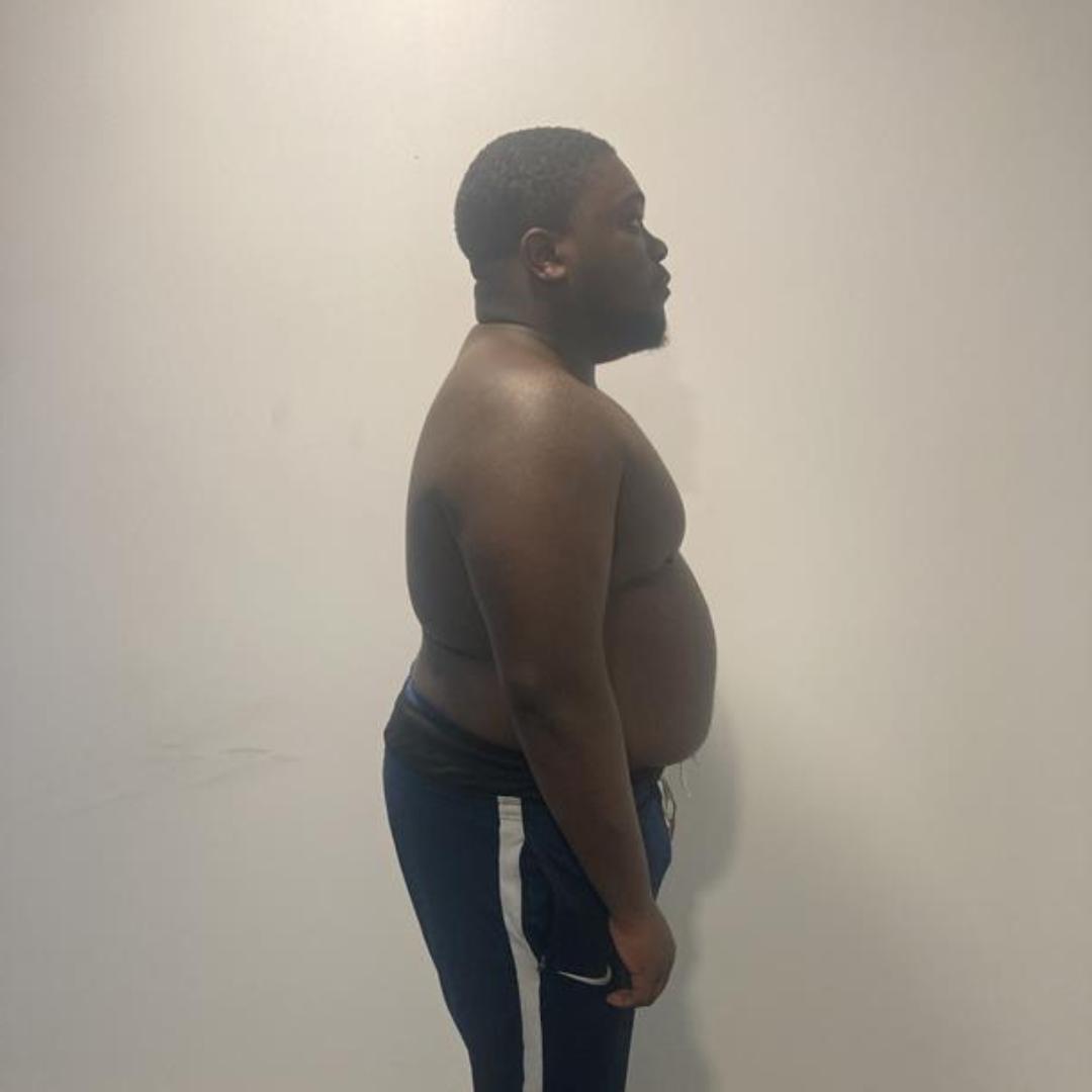 Before photo of Jermain