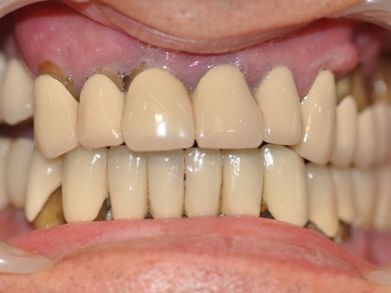 Before dental treatment - Patient case 1 showing initial condition
