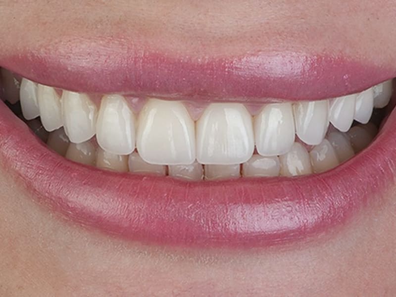 After treatment - Successful treatment results