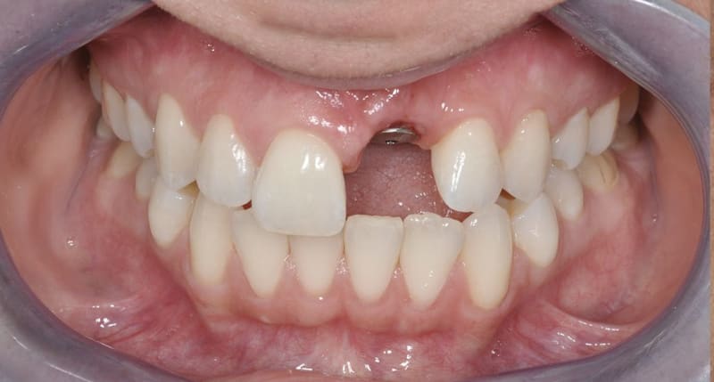 Before treatment - Initial patient condition