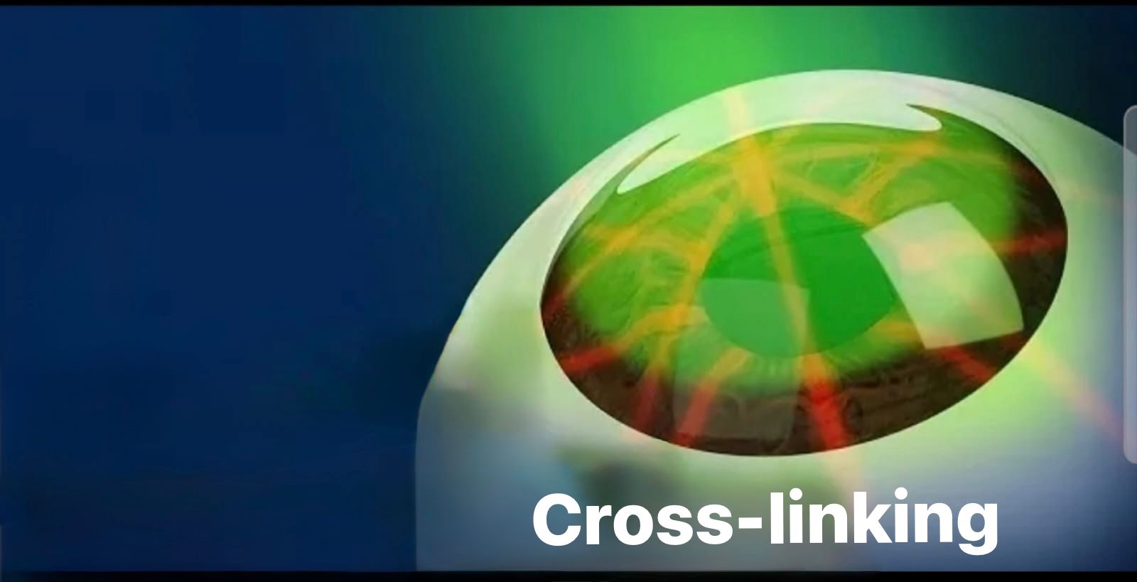 Cross-linking per il cheratocono