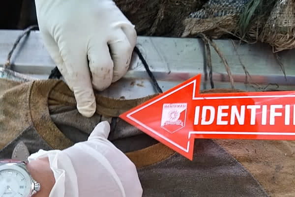 Ini Hasil Autopsi Mayat Pria Dalam Karung di Aceh Timur