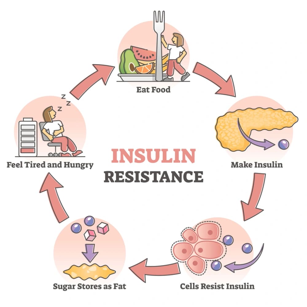 What is Insulin Resistance? Causes and Consequences featured image