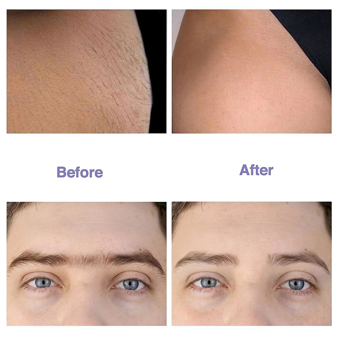 BioSwiss Kaş Usturası