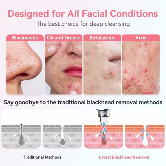 FREESHOW Siyah Nokta Temizleyici Gözenek Vakumu