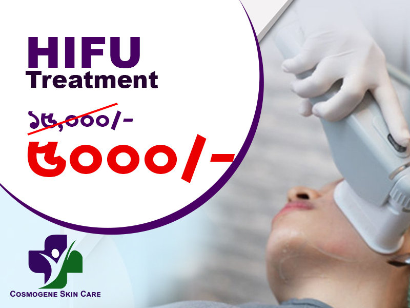 HIFU ??????????: ???? ???????? ? ?????–????-?? ?????? ??????