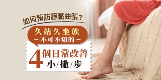 如何預防靜脈曲張？久站久坐族不可不知的4個日常改善小撇步