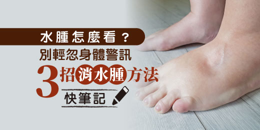 水腫怎麼看？別輕忽身體警訊，3招消水腫方法快筆記