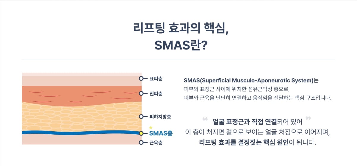 sms image