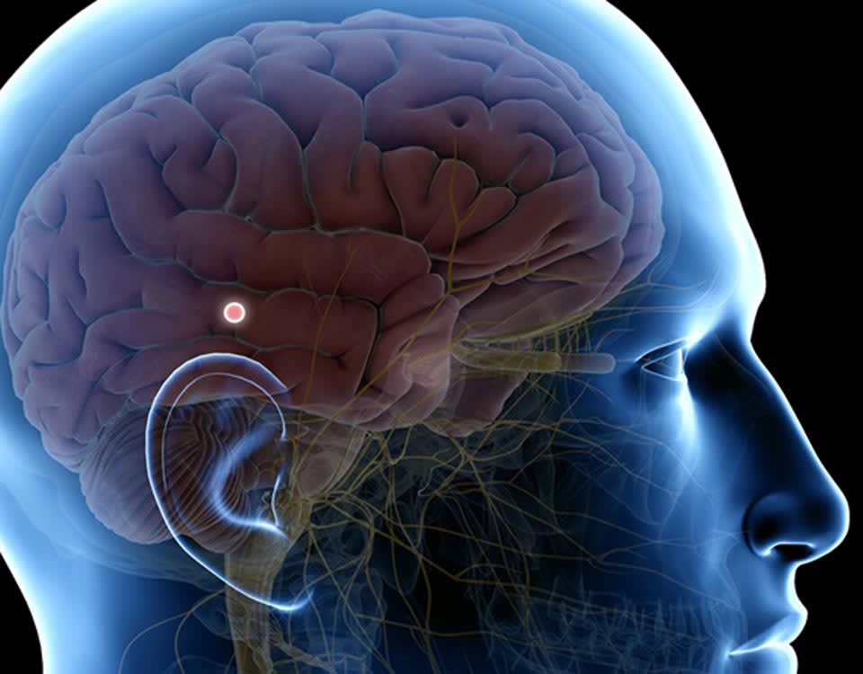 La calcificacion de la GLANDULA PINEAL