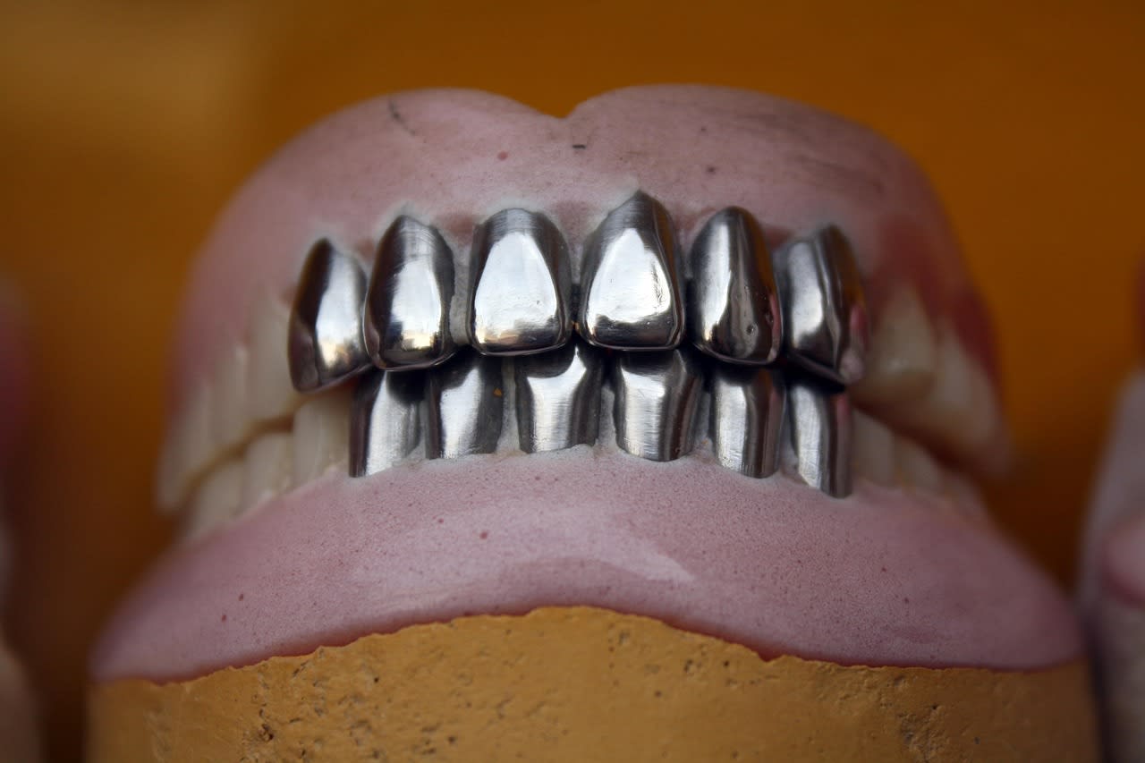 Imagen relacionada con Qué significa soñar con dientes que se caen y cómo cambia tu energía