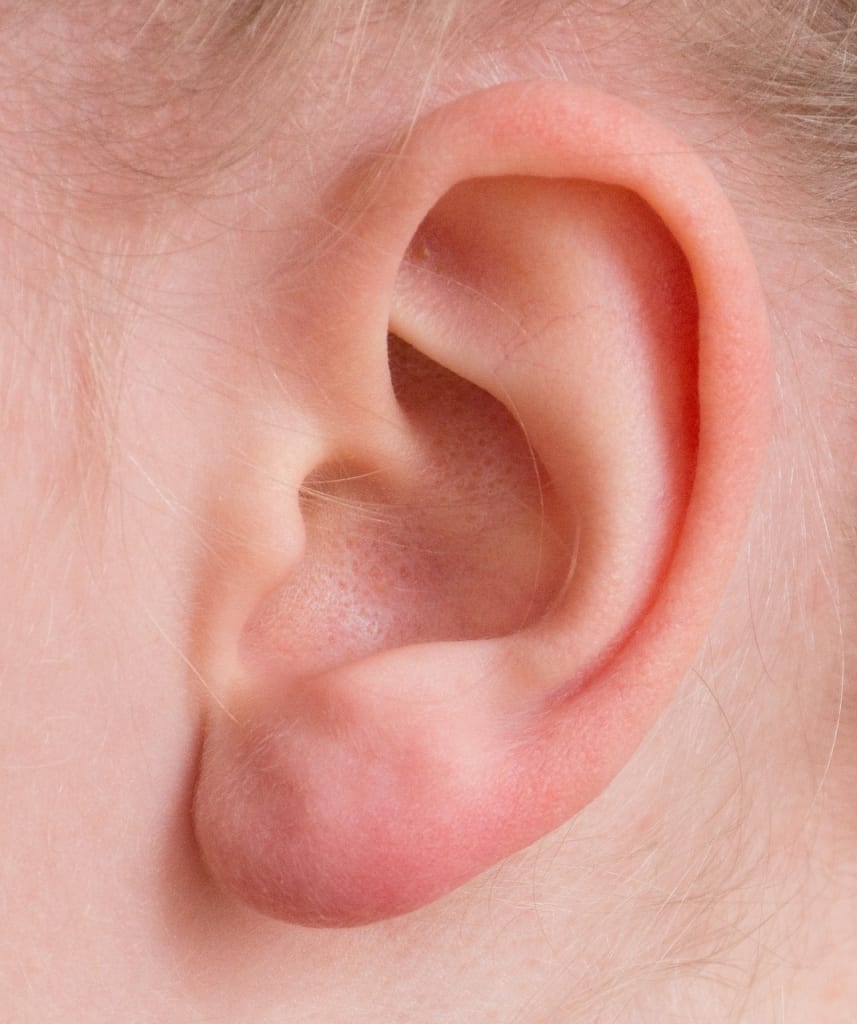 Imagen relacionada con Ear Seeding: ¿La técnica ancestral que deshincha tu rostro y reconecta tu energía?