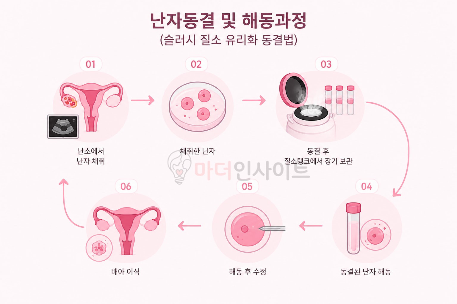 난자 해동