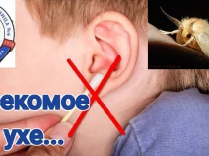 Пензенские врачи достали из уха пациентки моль