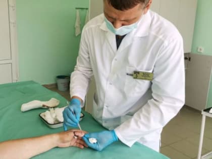 Пациенту из Пензы вернули отрезанный болгаркой палец