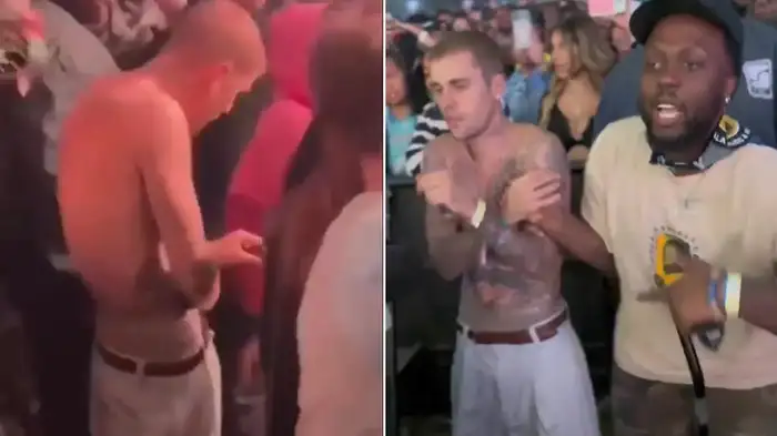 Justin Bieber’s Viral Coachella Video Sparks Concern — Fans Alarmed Over His Shocking Condition