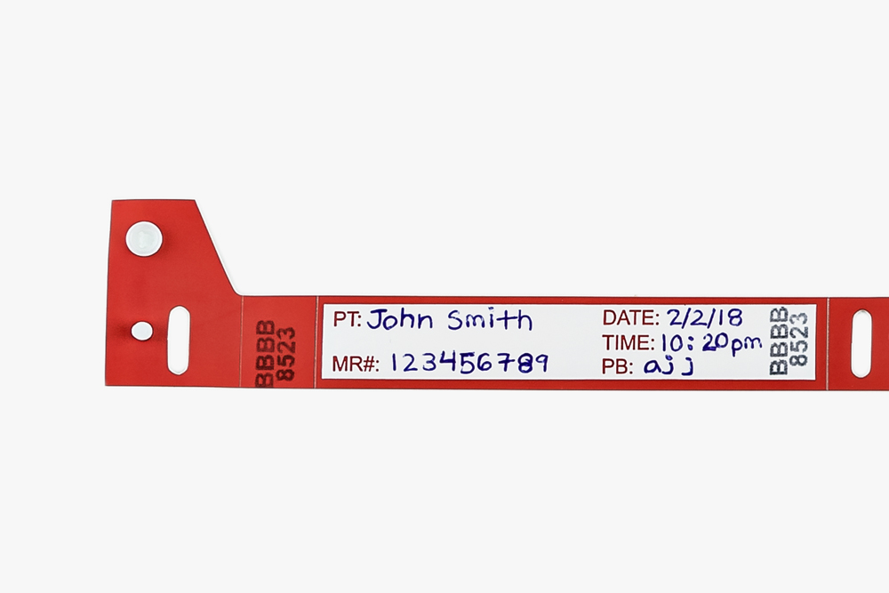 Close-up of red Typenex Medical non-barcoded Slim 3 blood band (AB0101R) with handwritten patient data.