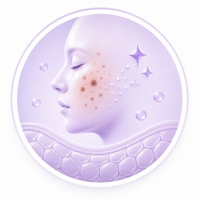 Pigmentation & Uneven Tone