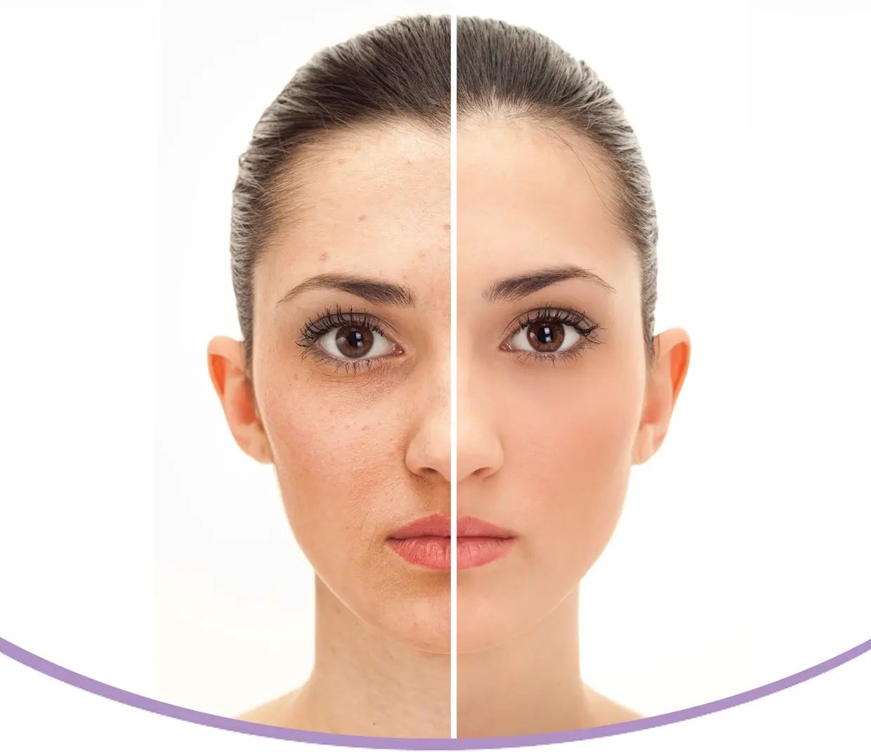 Anti-Aging