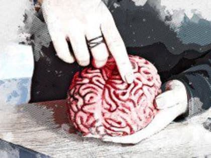 В Орловской области быстро растёт число больных рассеянным склерозом