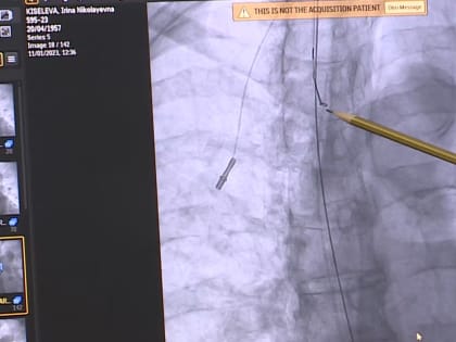 В Орле хирурги провели сложную операцию