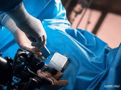 Для орловского онкологического диспансера приобретут аппарат брахитерапии