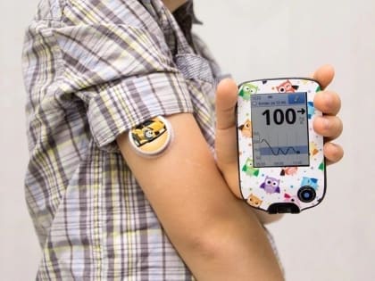 В Орле раздадут около 1,5 тысяч систем мониторинга глюкозы