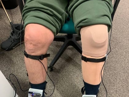 Российские ученые разработали возвращающий чувствительность протез ноги