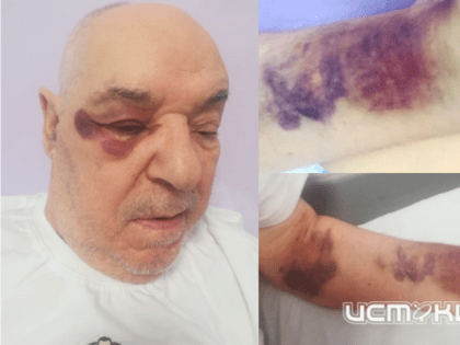 Депздрав проведет проверку по жалобе об избиении пациента с инсультом в Орловской больнице