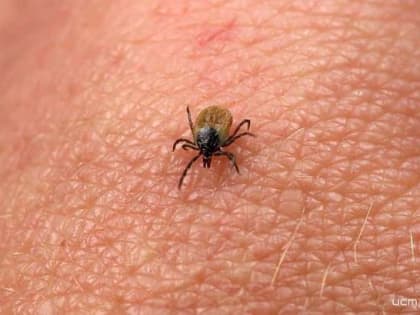 В Орловской области ещё 3 жителей заразились от клещей болезнью Лайма