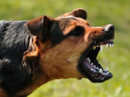 Орловчанке, которую покусали собаки, выплатят 100 тыс рублей