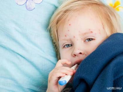 В Орловской области лабораторно подтверждены 7 случаев заболевания корью