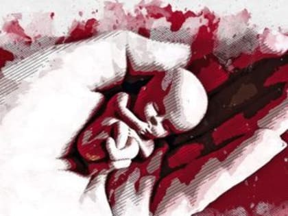 В Орловской области в год убивают свыше 1 тысячи неродившихся детей