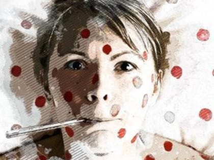 В Орловской области все очаги кори сняты с контроля