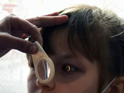 Распространенные офтальмологические заболевания у детей