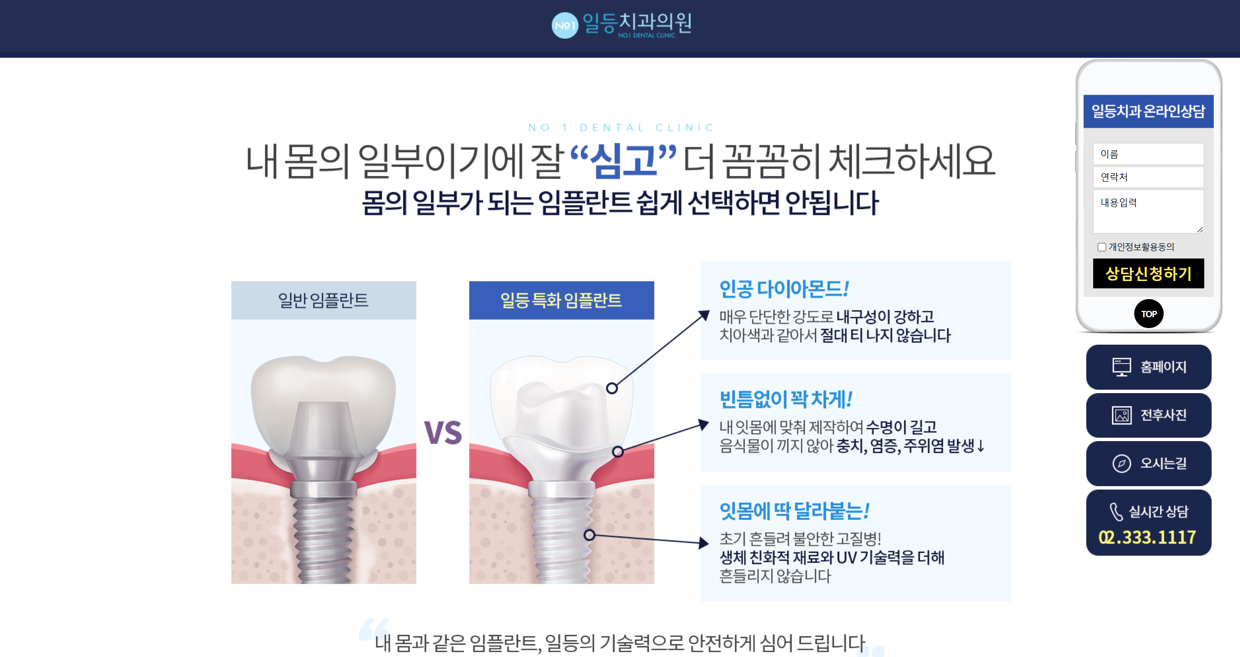 임플란트 랜딩(합정)