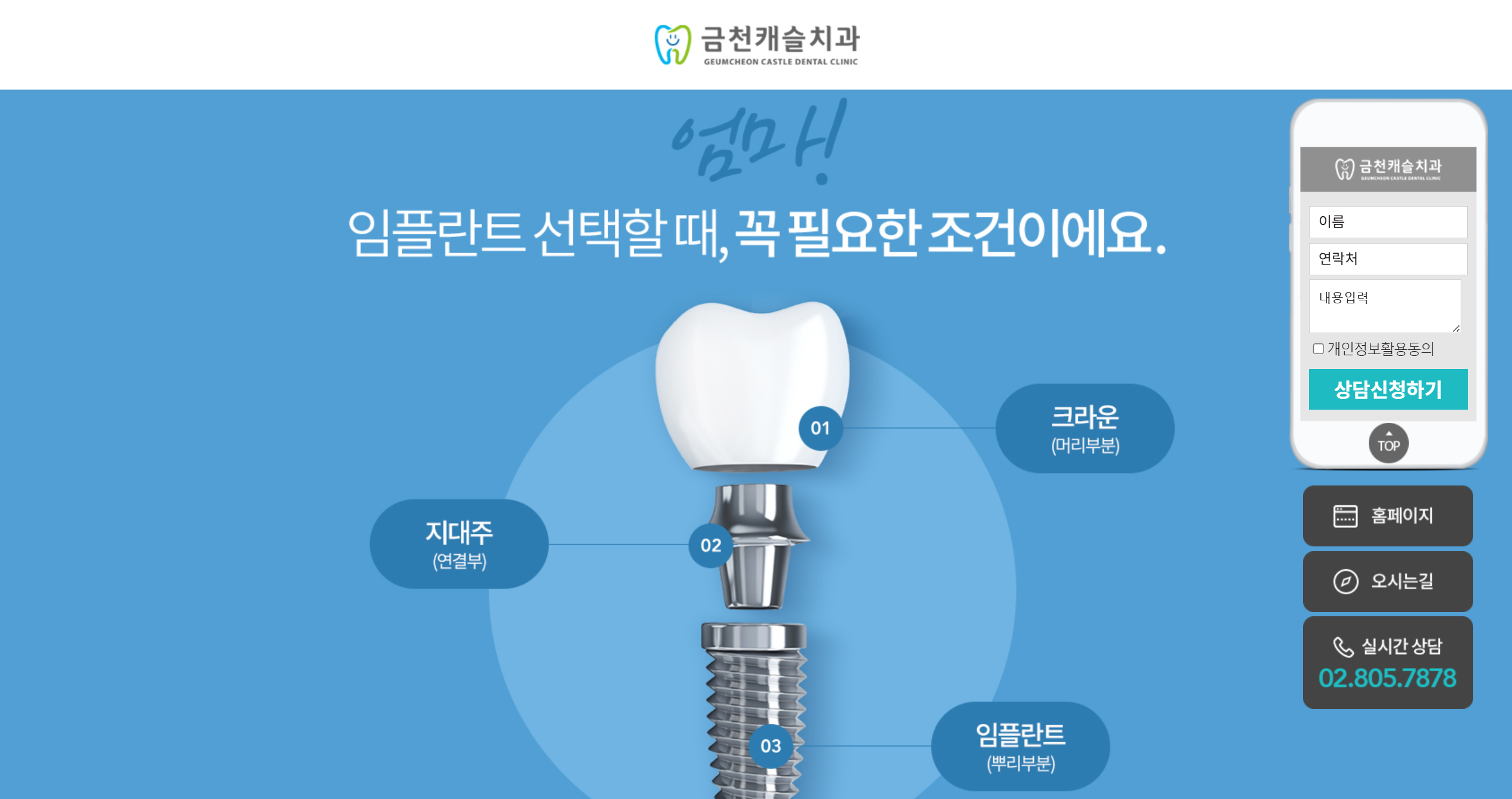 임플란트 랜딩(금천)