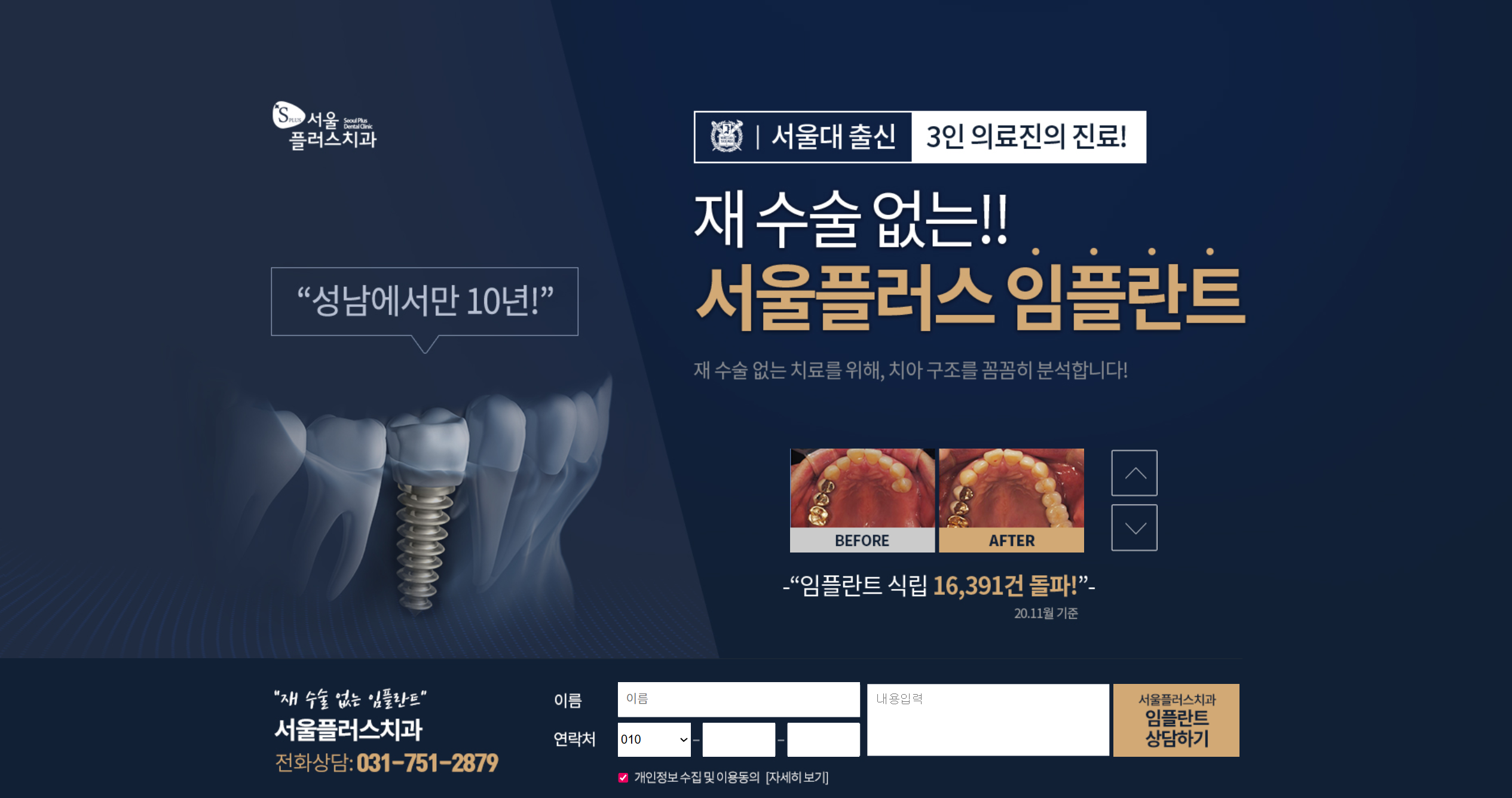 임플란트 랜딩(성남)