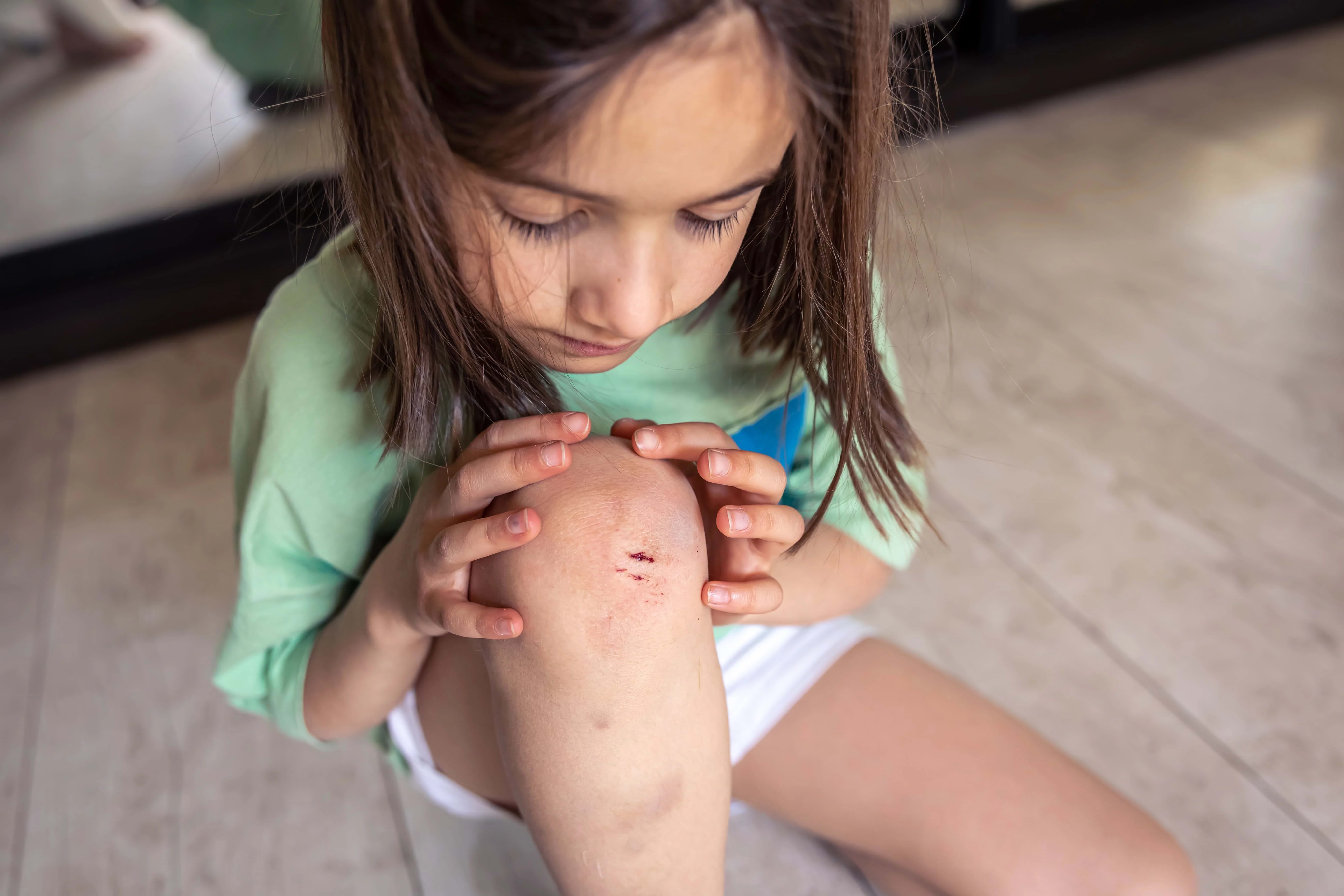The Fastest Ways to Remove Scars on the Skin