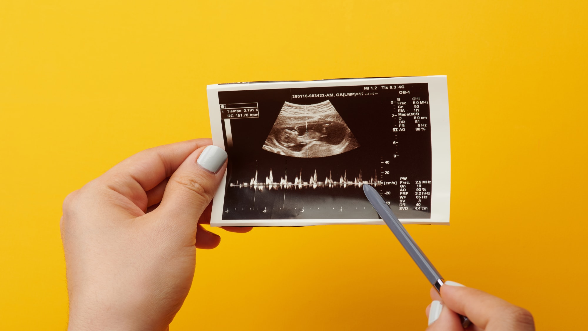 La Méthode du Bourgeon Génital : Le Secret Révélé et l'Approche Précise de BabyGender