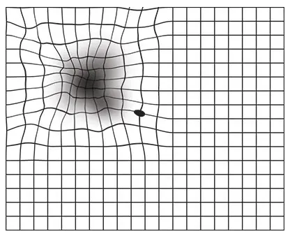 Abnormal Amsler grid test showing wavy or missing lines consistent with macular degeneration