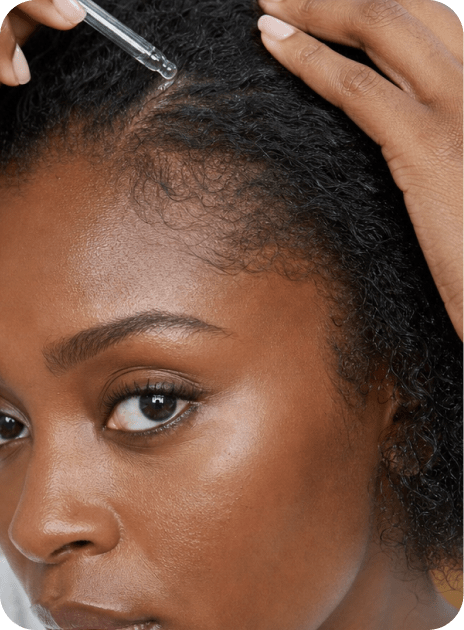 Hair loss and scalp
