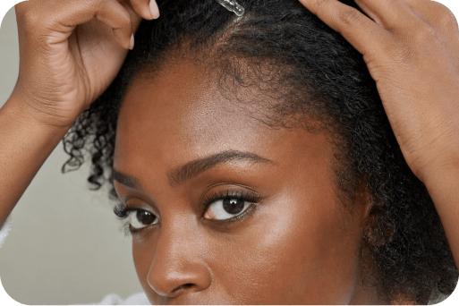 Hair loss