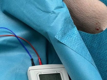 Установка временного кардиостимулятора спасла жизнь пенсионеру из Великих Лук