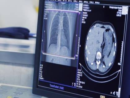 Искусственный интеллект в Псковской больнице: новая эра диагностики