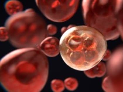 Онколог развеял популярные и опасные мифы о раке