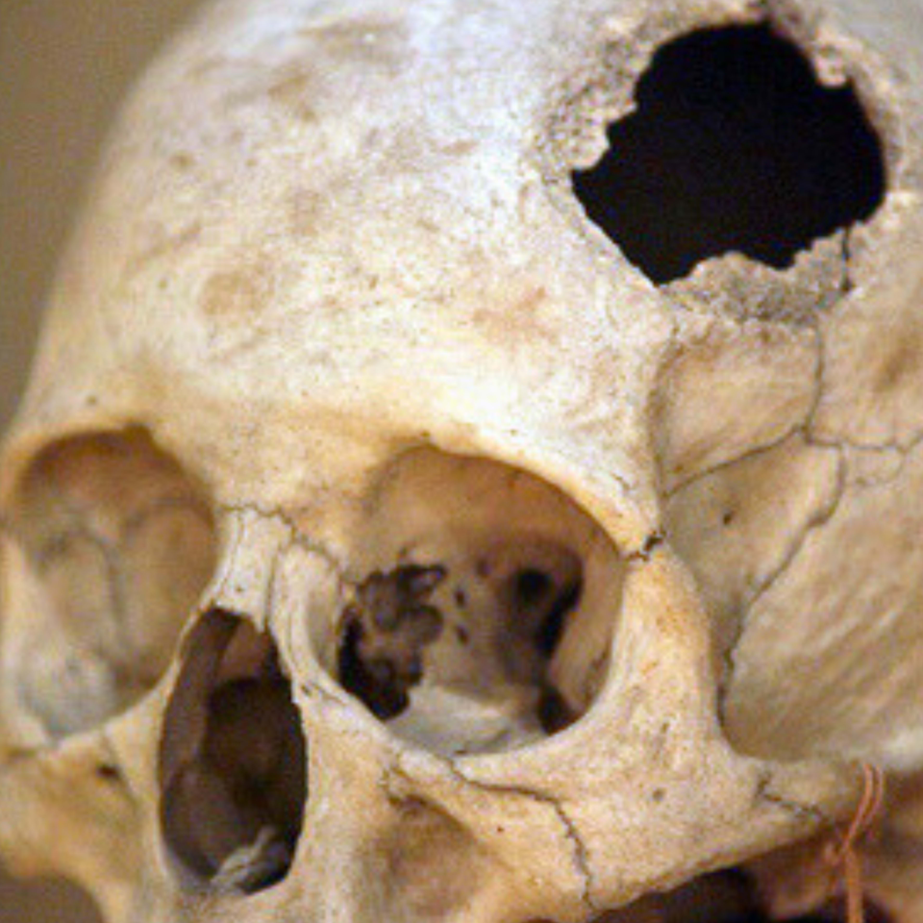 Musée international des sciences chirurgicales