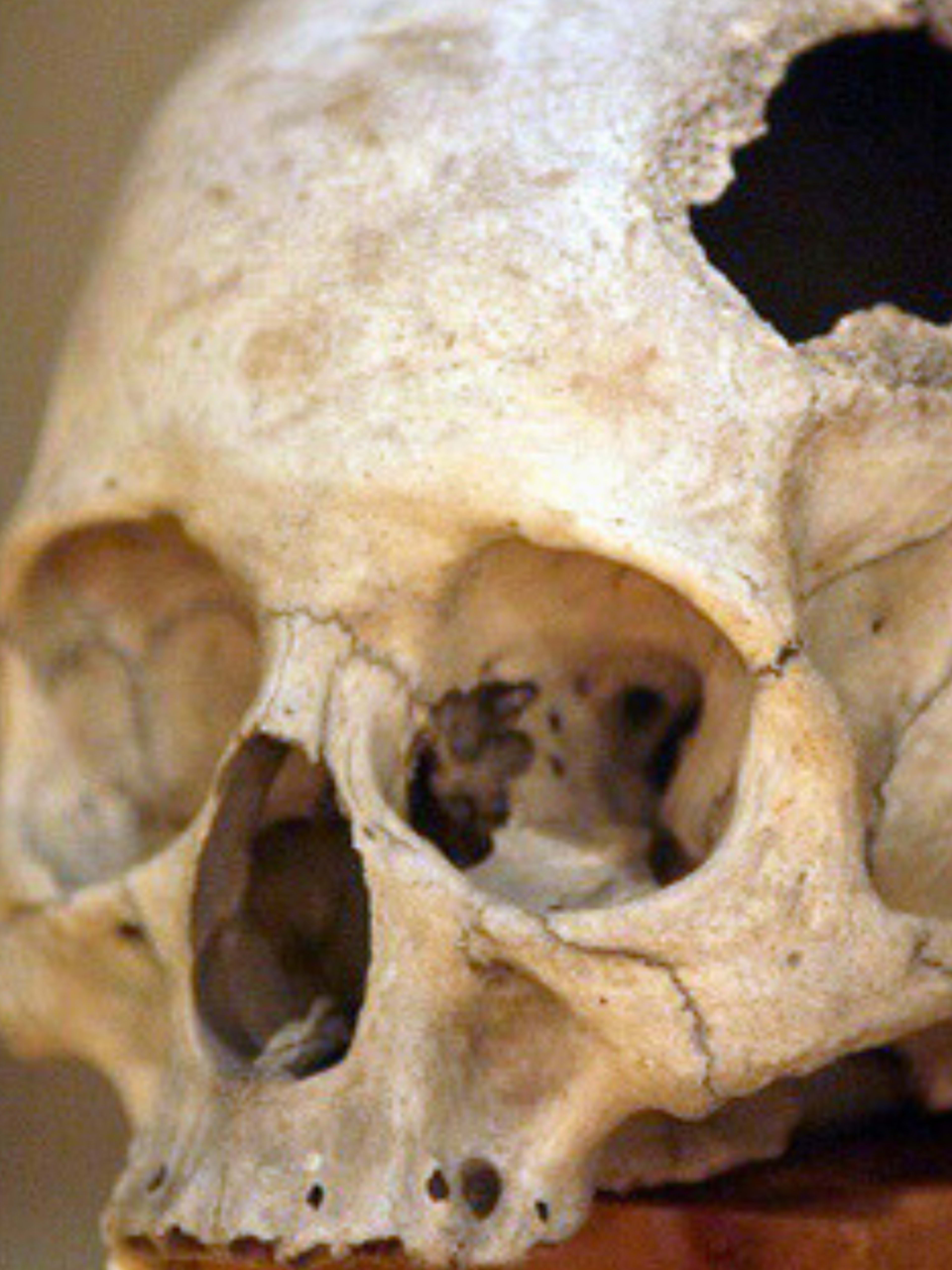International Museum of Surgical Science